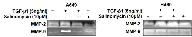 Salinomycin 처리시 MMP발현에 미치는 영향