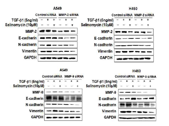 MMP-2,-9 억제시 EMT 단백질의 변화