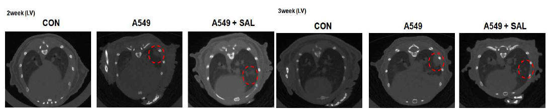 혈관을 통한 폐암의 전이모델에서 2, 3주후 micro CT 영상분석