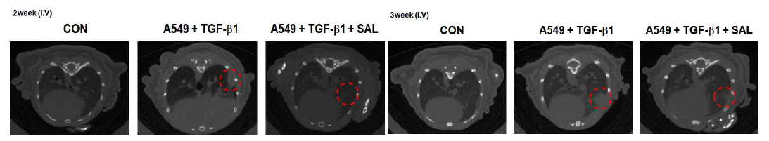 TGF-b1으로 유도된 폐암의 전이모델에서 2, 3주후 micro CT 영상분석