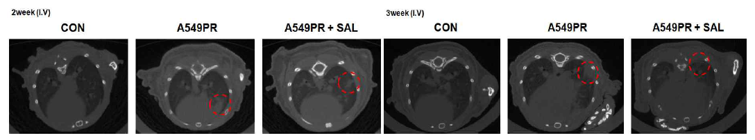 혈관을 통한 항암제 내성 폐암의 전이모델에서 2, 3주후 micro CT 영상분석