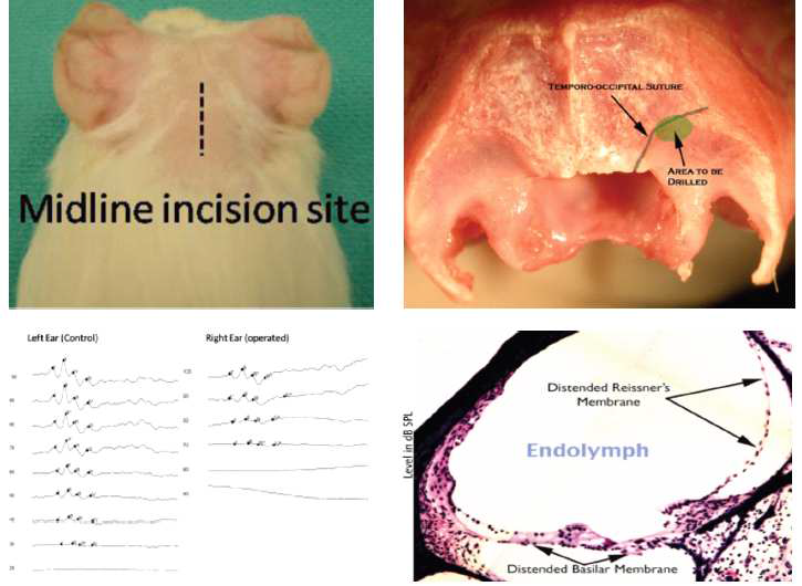 내림프낭 절제 모델 기니아 피그에서 피부 절개(좌상)을 통해 Temporo-occipital suture부위(우상)를 drilling하여 내림프낭을 노출시킨후 절제함. 12주 후 청력감소(좌하) 및 조직학적으로 내림프수종(우하)을 보임