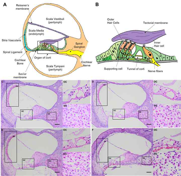 이독성 난청 동물 모델 입증, H&E 염색(C-F)에서 유모세포 손상 확인