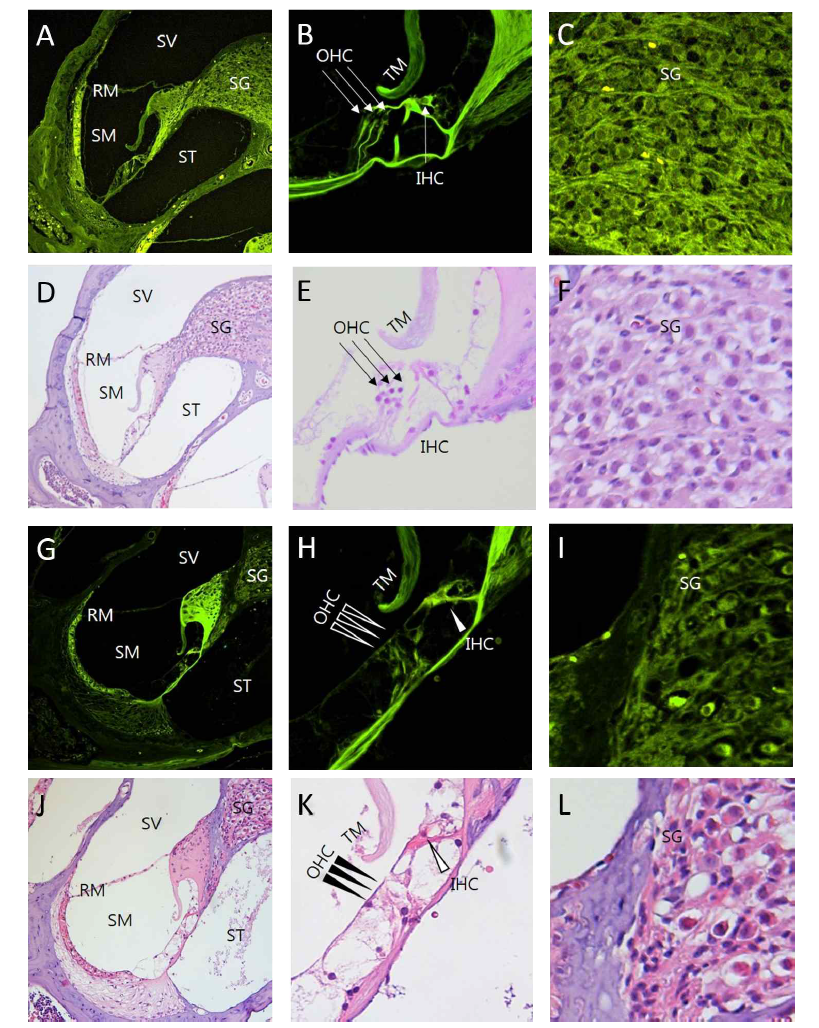 이독성 난청 동물 모델에서 달팽이관의 코르티 기관의 손상 모습 시각화