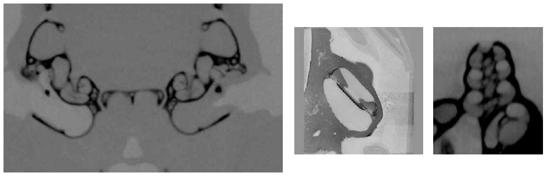 micro-CT를 활용하여 얻은 scala media 사진