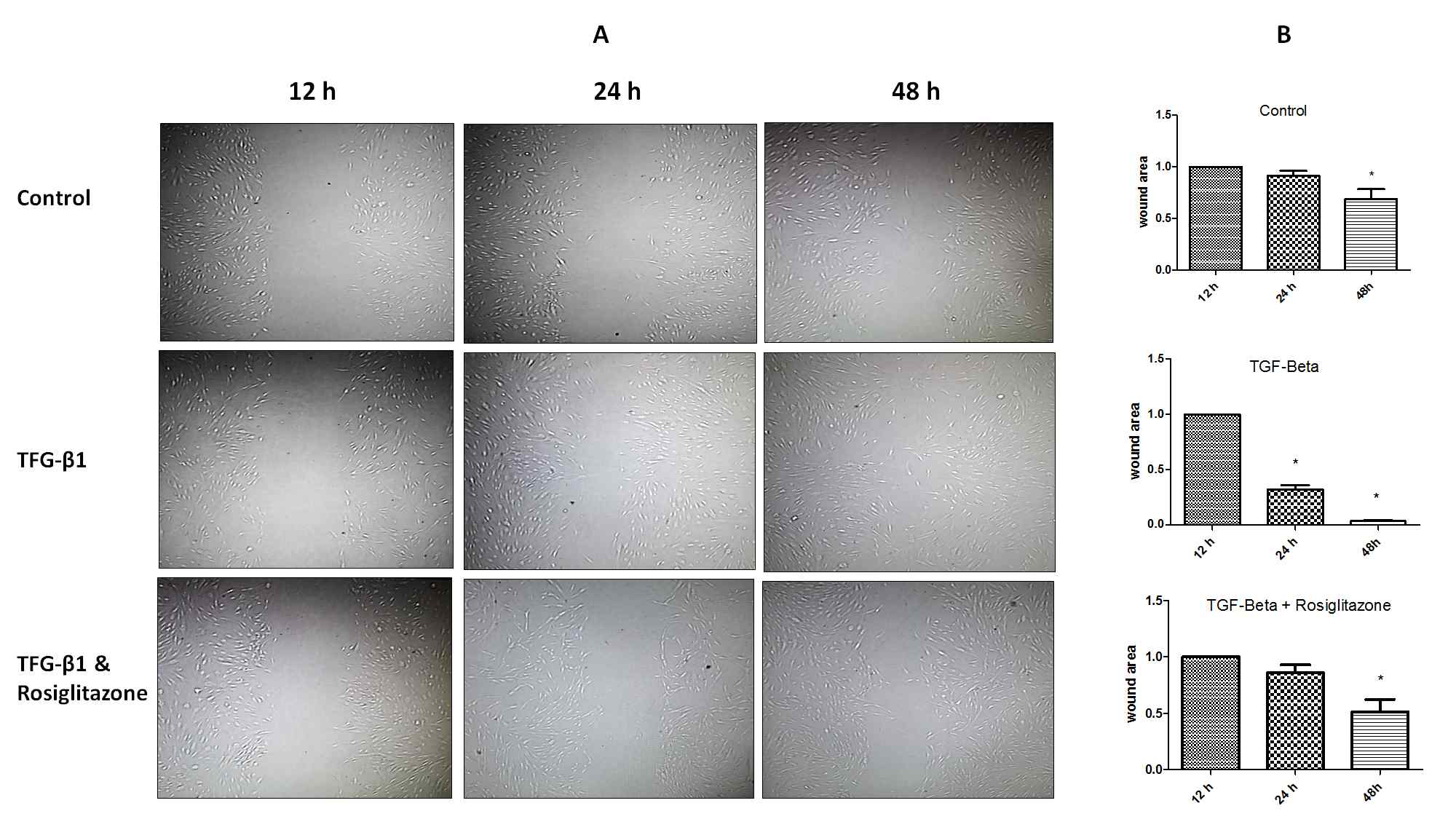 migration assay. 익상편 세포의 배양조건에서 TGF-β 자극과 rosiglitazone이 세포 이동에 미치는 영향을 분석함