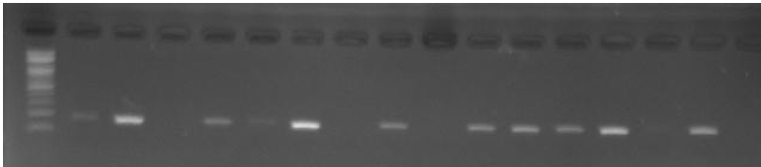 PCR for methylated AQP1