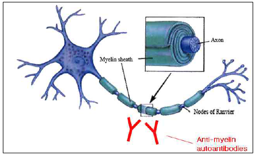Structure of human nervous system and myelin targetiing autoantibodies (filled with red) (modified from www.genericlook.com)