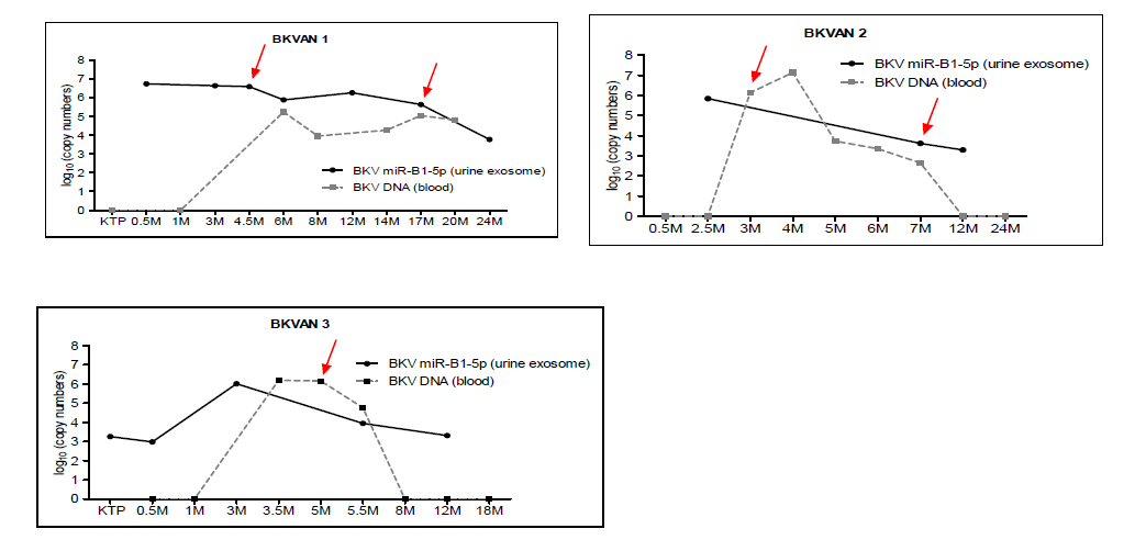 조직학적으로 BKV 신증으로 진단된 개별환자의 소변 exosomal BKV miR와 혈액 BKV DNA의 비교