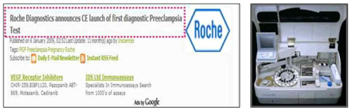 로슈에서 개발된 임신중독증의 감별진단을 위한 전자동 임신중독증 면역검사시스템