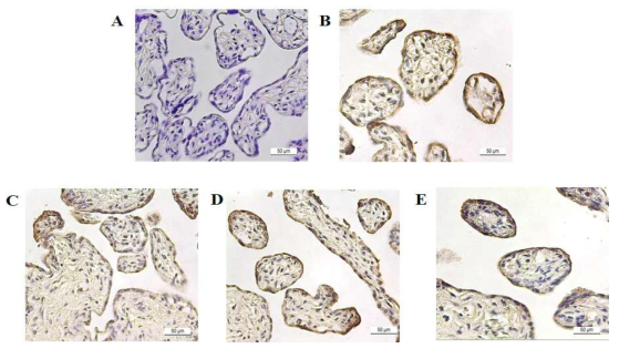 임신 말기 태반에서 스테로이드 호르몬 대사관련 효소의 면역염색 (A) CYP11A1, (B) CYP17A1, (C) HSD17B3, (D) HSD3B1, (E) CYP19A1