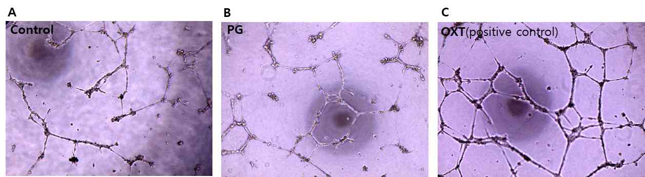 마커호르몬 처리에 따른 HUVEC tube formation의 변화 (A)Control, (B)PG, (C)Oxytocin