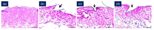 (a) 아무것도 처리하지 않은 그룹의 피부 조직, (b) 비다공성 마이크로니들을 10분간 적용한 그룹의 피부 조직, 나노다공성 마이크로니들을 (c) 1분, (d) 10분간 적용한 그룹의 피부 조직