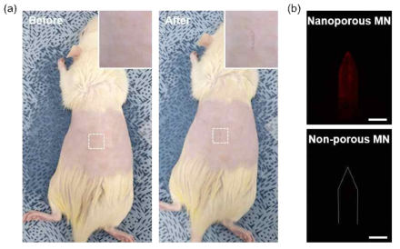 (a) 마이크로니들 적용 전과 후의 랫트 피부 표면 사진. (b) E2 캡처를 위해 랫트 피부에 적용한 후의 나노다공성 및 비다공성 마이크로니들의 형광 이미지. Scale bar: 200 μm
