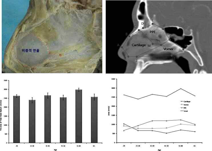 사체와 전산화단층 촬영상에서 코중격 연골의 구조와 연령에 따른 면적분석