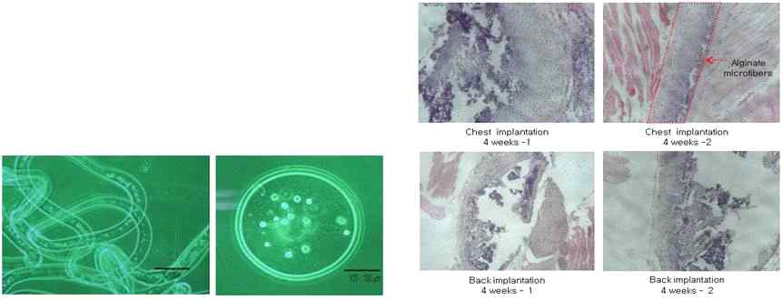 코중격 연골세포가 들어있는 alginate microfiber와 생체 내 이식 후 조직학적 분석