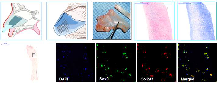 사람 코중격 연골에서의 연골 특이 단백질 발현 확인
