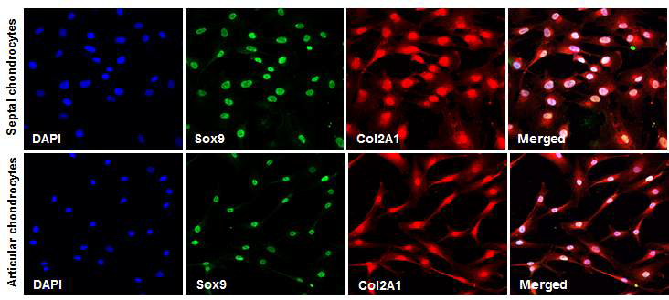사람 코중격 연골세포와 관절연골세포 에서의 연골 특이 단백질 발현 분석