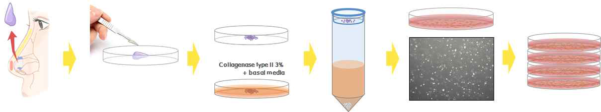 사람 코중격 연골세포의 분리와 대량 증식 기술 확립