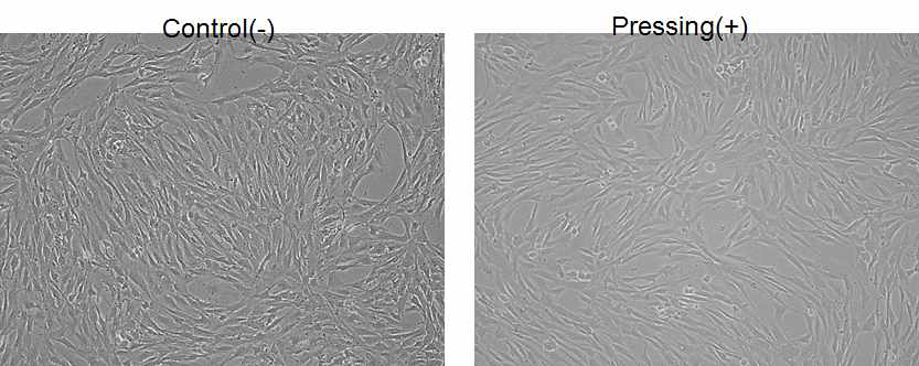 압력 유무에 따른 hNSC의 형태 변화