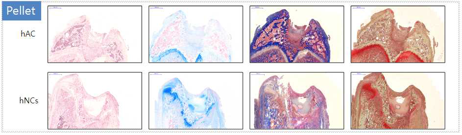 무릎연골 세포치료제 이식 후 조직학적 분석