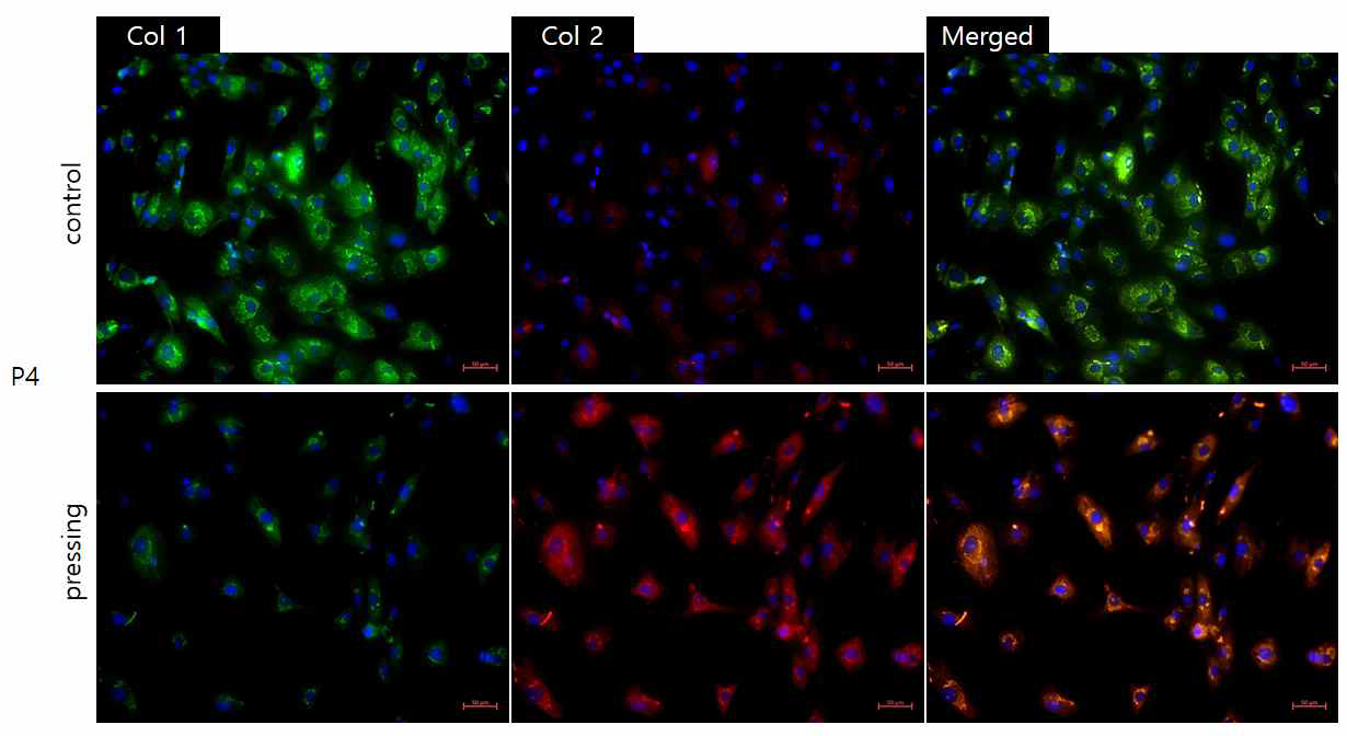 COL1, COL2 면역형광 염색법을 이용한 연골세포 탈분화 억제효과 분석