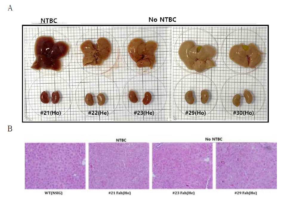 NTBC 공급 중단에 따른 간의 육안적 소견(A)과 간의 H&E 염색 (B) 결과