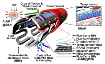 생체흡수성 스마트 스텐트. 다양한 센서와 결합되어 있으며, 치료를 위한 약물 코팅이 되어있다 (Son et al., 2015)