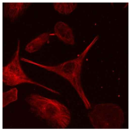 Confocal image of live HeLa cell expressing SNAP-FtnA, red fluorescence collected at 647 nm