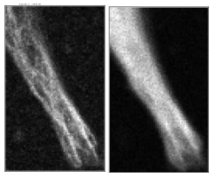 Protein-Microtubule co-localization