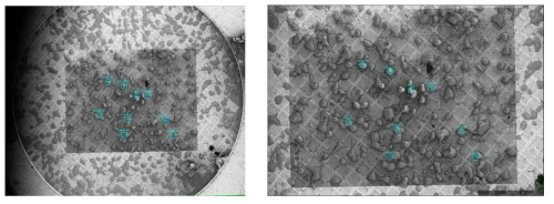 SEM image of cells attached on grid