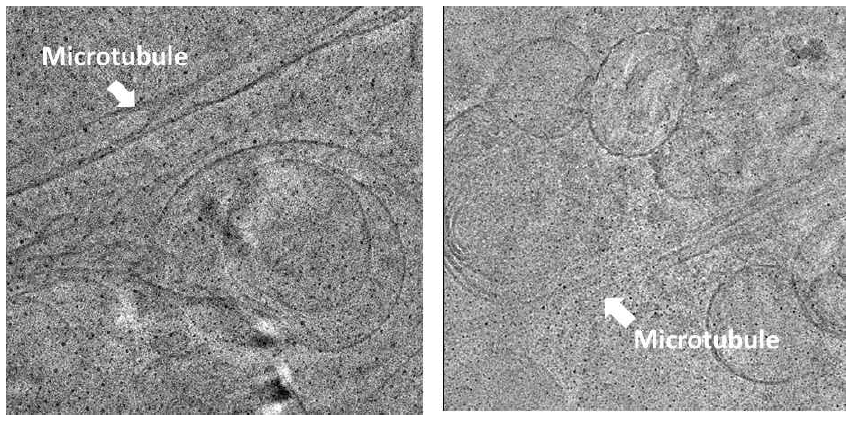 preliminary cryo-ET data. HeLa cell without any transfection