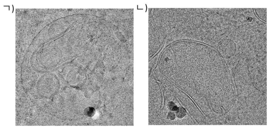 Tomogram of ㄱ) MVB, ㄴ) Mitochondria