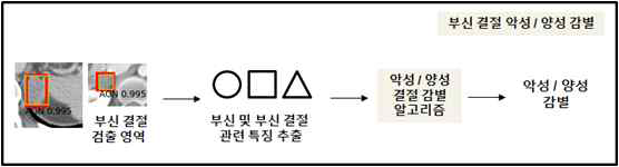 부신 결절 악성/양성 감별 알고리즘