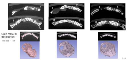 토끼 두개골의 micro CT 영상 및 3차원 재건 영상