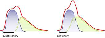 혈관 경직도에 따른 동맥 압력 파형. 입사파와 반사파로 구성. 좌-경직도가 낮은 경우, 우-경직도가 높은 경우