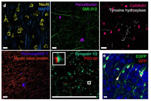 탄성화 조직 내에 보존된 생체분자 표지 능력. 우하단: FISH를 이용한 mRNA 표지 (GFP 및 vGluT1)