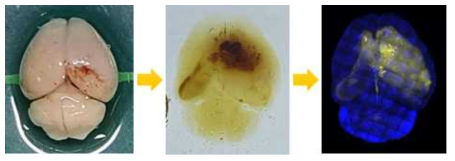 교모세포종 발생 생쥐 뇌의 투명화 및 대단위 3차원 현미경 촬영