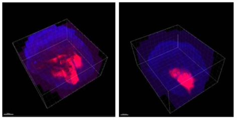 교모세포종 발생 생쥐 개체간 종양 발생 부위 및 범위의 입체적 관찰 및 시스템적 비교