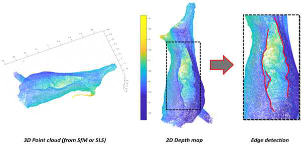 3D 모델(SfM 3D 모델)로부터 갈비뼈의 형상 감지