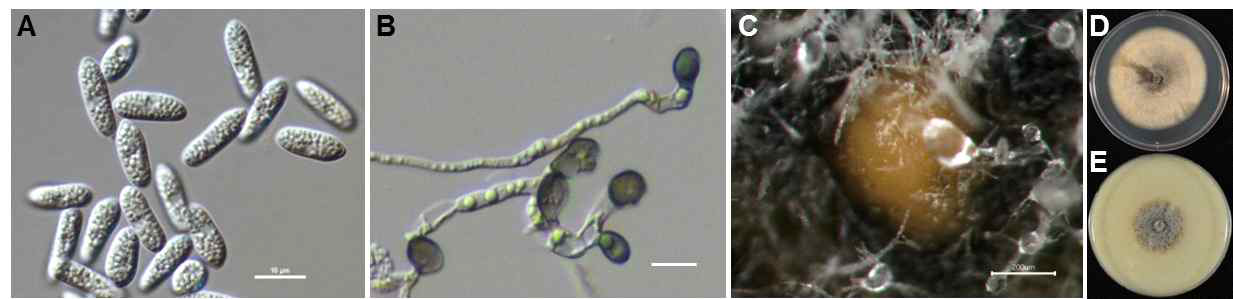 무에서 분리한 Colletotrichum higginsianum의 균학적 특성. A, conidia; B, appressoria; C, acervuli; D, colony on PDA; E, colony on OA. Scale bars of A and B =10μm. Scale bar of C = 200μm