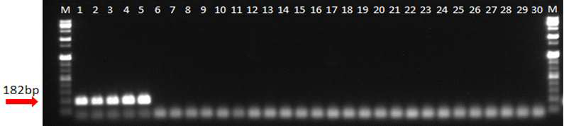 PCR amplification of the LysR family transcriptional regulator with the primers. Lane M is the size marker (1 kb DNA plus ladder; Gibco BRL) while lanes 1 to 10 were L. mesenteroides strains, lanes 11 to 29 were included strains from other Leuconostoc species, Weissella species and Lactobacillus species as listed in Table 1 and lane 30 was a negative control (distilled water)