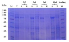 SDS-PAGE를 통한 단백질 발현 확인