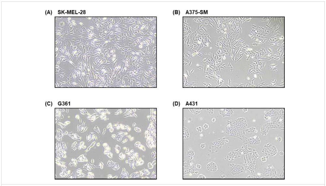 Skin cancer cell line Morphology (A)SK-MEL-28: malignant melanoma, (B)A375-SM: melanoma, highly metastatic, (C)G361: Caucasian, melanoma, (D)A431: carcinoma, epidermoid