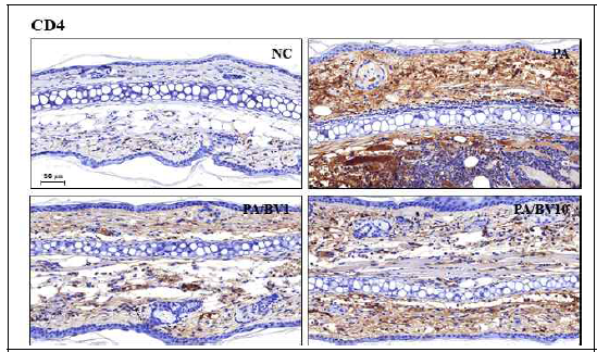 P.acnes 균주로 유도된 동물모델에서 봉독의 효능 확인_CD4