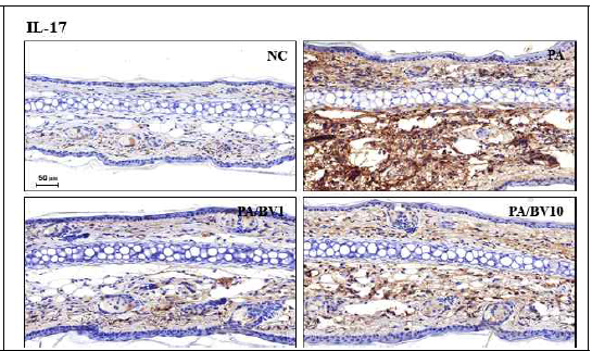 P.acnes 균주로 유도된 동물모델에서 봉독의 효능 확인_IL-17