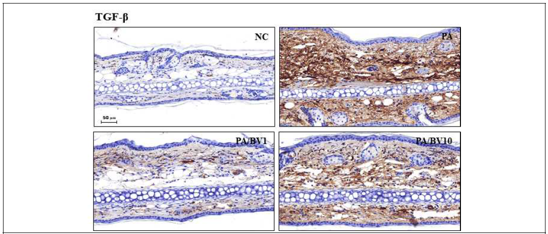 P.acnes 균주로 유도된 동물모델에서 봉독의 효능 확인_TGF-β1