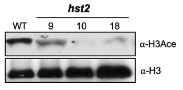 HST2는 히스톤 H3 아세틸화를 조절