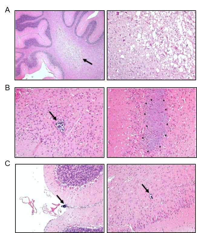 형질전환 자돈의 조직학적 분석(Histological analysis) (A) 소뇌 백질 부위에서의 탈수초화 및 공포화 현상 (B) 대뇌에서의 국소적 괴사 (C) 소뇌의 뇌막(좌)과 대뇌의 실질 (우)에서 국소적인 칼슘침착 현상 발생. 화살표는 관련현상이 일어난 부위를 표시함