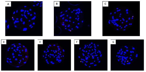 p38 저해제 처리에 따른 세포사 분석 빨강 : TUNEL 염색을 통한 세포사 분석, A: Control, B: DMSO (0.1%), C: 5 uM, D: 10 uM, E: 20 uM, F: 50 uM, G: 100 uM